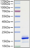 Recombinant Human CCL21 Protein (RP01402)