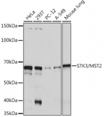 STK3/MST2 Rabbit mAb (A9036)