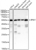 IP6K1 Rabbit mAb (A22272)