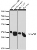 SNAP25 Rabbit mAb (A2234)