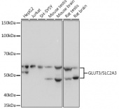 GLUT3/SLC2A3 Rabbit mAb (A4137)