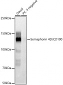 Semaphorin 4D / CD100 Rabbit mAb (A21070)