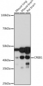 CREB Rabbit mAb (A10826)