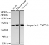 Karyopherin β3 (IPO5) Rabbit mAb (A22764)