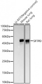 SFTPD Rabbit mAb (A22660)