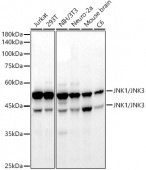 JNK1/JNK3 Rabbit mAb (A22376)