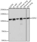 DDR2 Rabbit mAb (A4296)