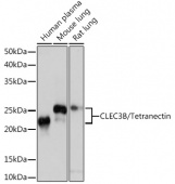 CLEC3B/Tetranectin Rabbit mAb (A4387)