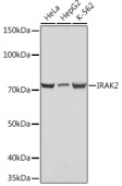 IRAK2 Rabbit mAb (A4655)