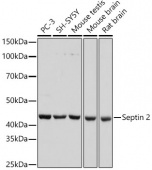 Septin 2 Rabbit mAb (A7163)