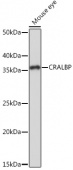 CRALBP Rabbit mAb (A9265)