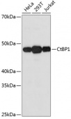 CtBP1 Rabbit mAb (A11600)