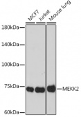 MEKK2 Rabbit mAb (A19739)