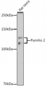 Pumilio 2 Rabbit mAb (A19783)
