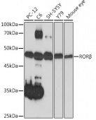 RORβ Rabbit mAb (A19753)