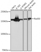 Rad50 Rabbit mAb (A3869)