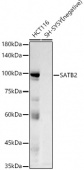 SATB2 Rabbit mAb (A20220)