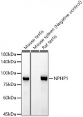 NPHP1 Rabbit mAb (A21079)