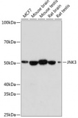 JNK3 Rabbit mAb (A19075)