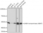 GABA transaminase (ABAT) Rabbit mAb (A9146)