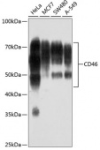 CD46 Rabbit mAb (A19022)