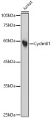 Cyclin B1 Rabbit mAb (A22435)