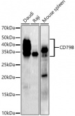 CD79B Rabbit mAb (A21224)