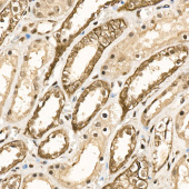DSCR1 Rabbit mAb (A23086)