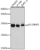 p53 DINP1 Rabbit mAb (A5952)