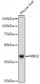 MBD2 Rabbit mAb (A4032)