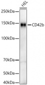 CD42b Rabbit mAb (A22277)