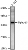 Siglec-15 Rabbit mAb (A20773)