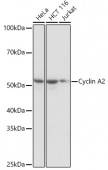 Cyclin A2 Rabbit mAb (A19036)