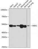 MEK1 Rabbit mAb (A19565)