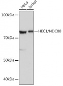 HEC1/NDC80 Rabbit mAb (A2392)