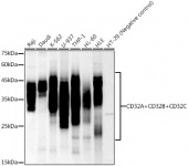 CD32A + CD32B + CD32C Rabbit mAb (A21073)