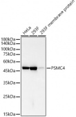 PSMC4 Rabbit mAb (A22715)