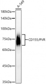 CD155/PVR Rabbit mAb (A23084)