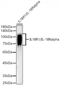 IL18R1/IL-18 R alpha Rabbit mAb (A22369)