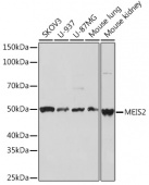 MEIS2 Rabbit mAb (A3566)