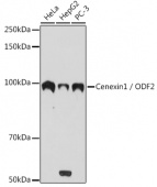 Cenexin1 / ODF2 Rabbit mAb (A3607)