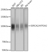 SERCA2/ATP2A2 Rabbit mAb (A11692)