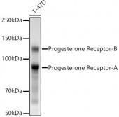 Progesterone Receptor Rabbit mAb (A22061)