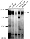LRP5 Rabbit mAb (A21177)