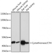 Cystathionase/CTH Rabbit mAb (A5101)