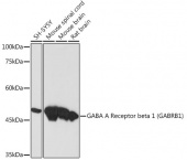 GABA A Receptor beta 1 (GABRB1) Rabbit mAb (A19681)