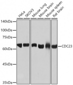 CDC23 Rabbit mAb (A6025)