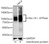 Na+/K+-ATPase Rabbit mAb (A11683)