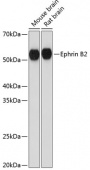 Ephrin B2 Rabbit mAb (A11349)