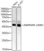 MAPKAPK-2/MK2 Rabbit mAb (A22183)